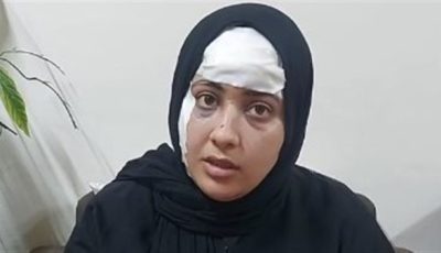 خطف ابني وشوهلي وشي| بث مباشر