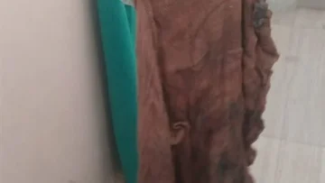 تأييد حكم بالسجن لطبيب جراحة في قنا لعام واحد بعد نسيانه فوطة داخل بطن مريضة أدت وفاتها نتيجة الإهمال.