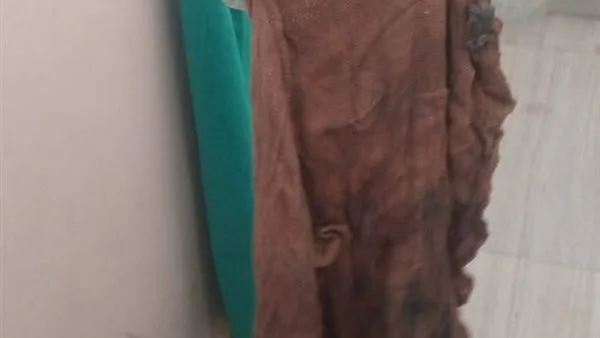 تأييد حكم بالسجن لطبيب جراحة في قنا لعام واحد بعد نسيانه فوطة داخل بطن مريضة أدت وفاتها نتيجة الإهمال.