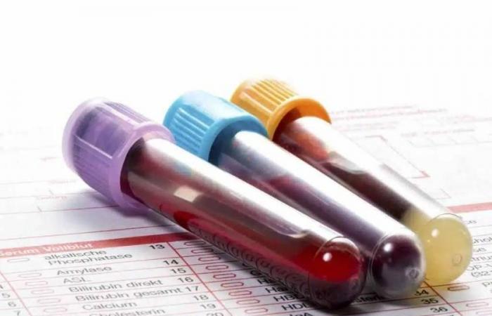 بعد سن الأربعين.. لا تتجاهل هذه التحاليل الستة قد تنقذك من أزمات مفاجئة