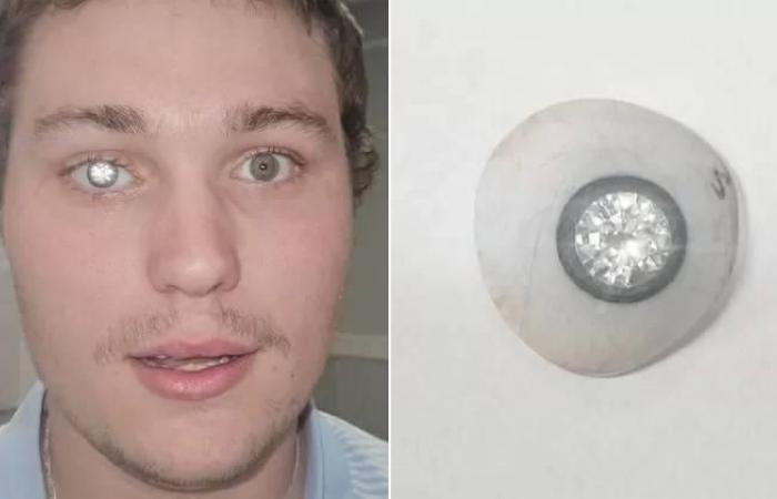 عين أمريكي.. ألماسة قيراطين