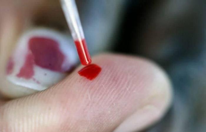 فحص بسيط للدم يمكن أن يساعد على تحديد قوة العلاج الكيميائي